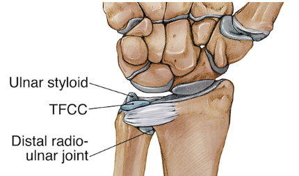 Wrist Sprain TFCC injuries in Raleigh NC